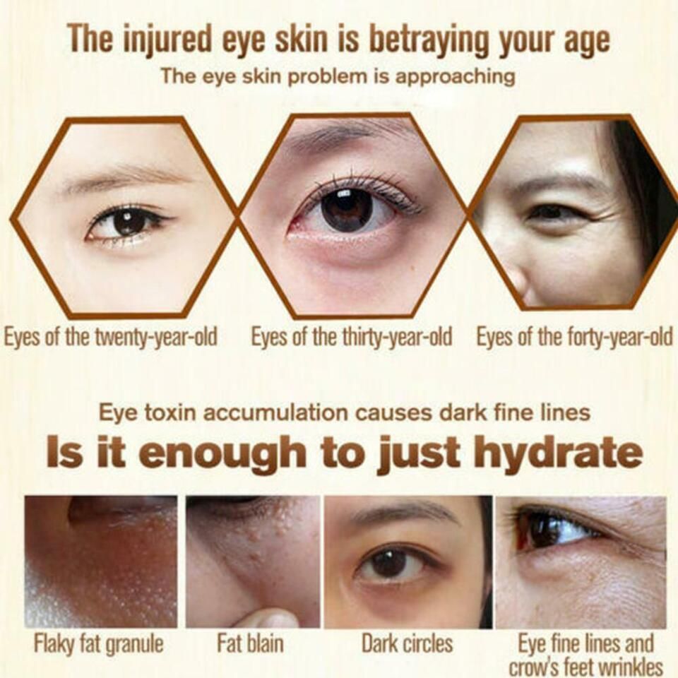 Remove Dark Circles Wrinkles Eye Bags Fat Granules Serum Oil