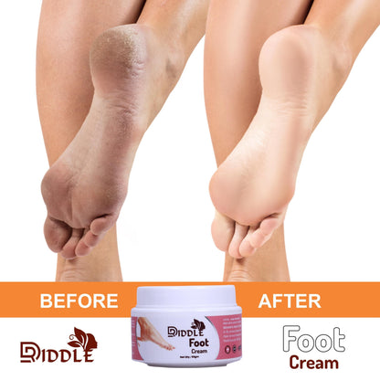 DRIDDLE Healthy Feet Treatment Foot Cream (50gm) (Pack of 4)