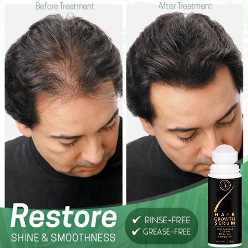 Regrowth Organic Hair Serum Roller 45ml