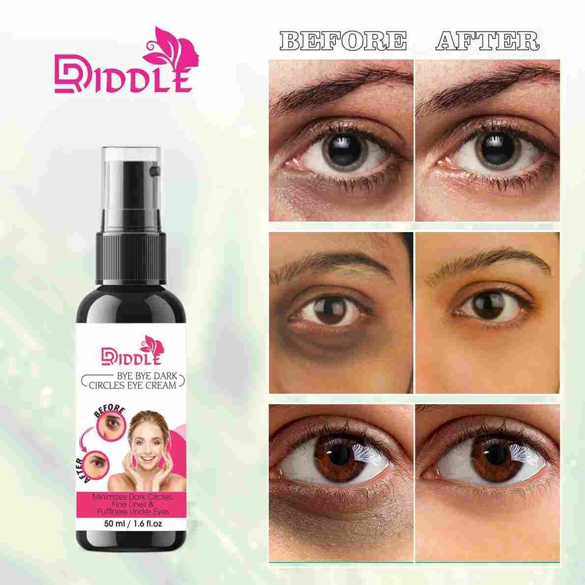 Driddle Under Eye Cream For Dark Circles Removal, Eye Puffiness,Fine Lines & Wrinkles  (60 g)