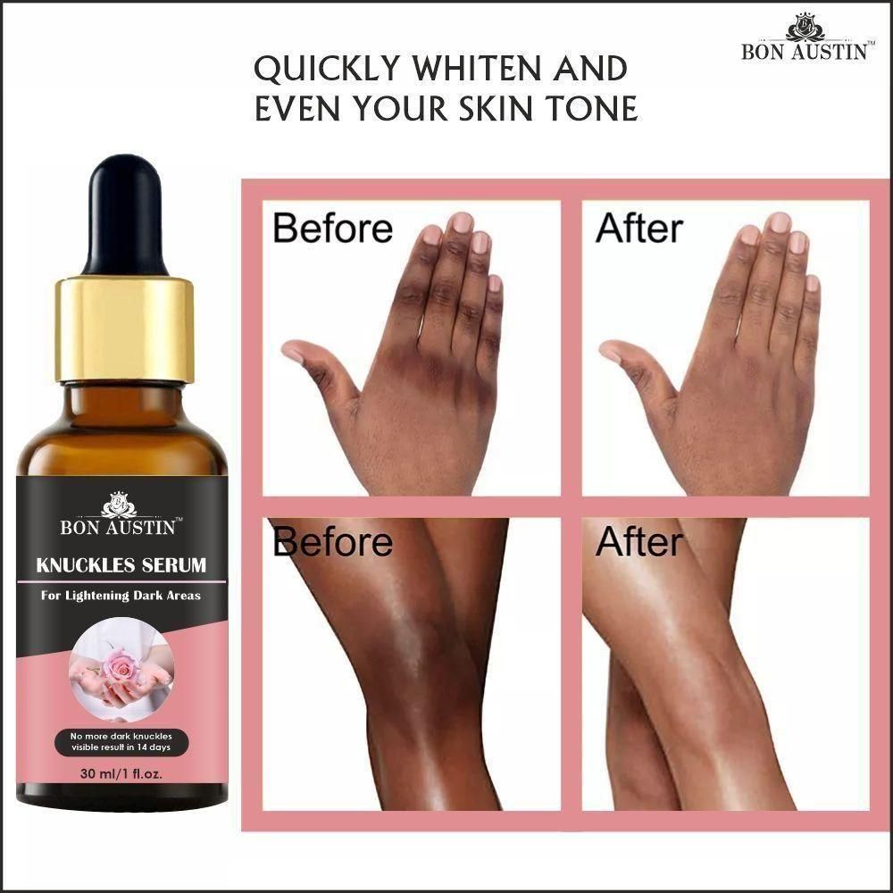 Bon Austin Skin Whitening Serum